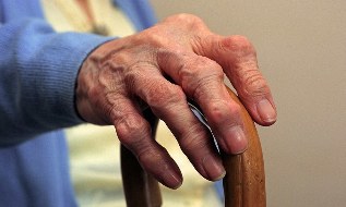 Artritis dan arthrosis jari pada orang tua