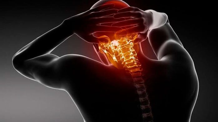sakit kepala dengan osteochondrosis serviks