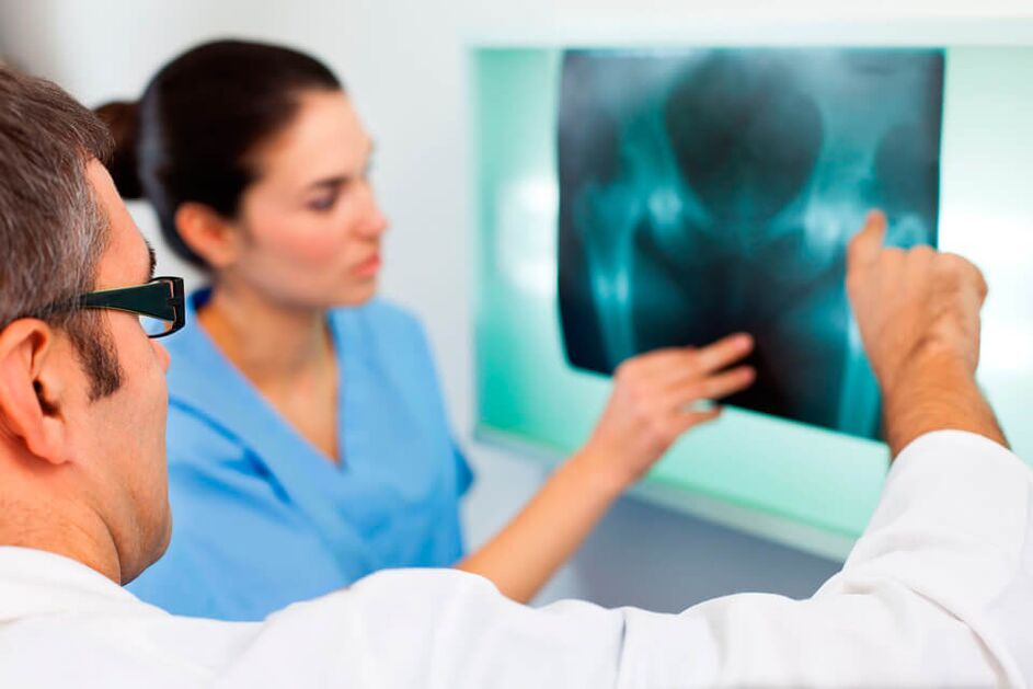 Pakar rheumatologi atau traumatologi mendiagnosis kesakitan pada sendi pinggul. 