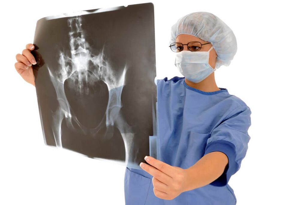 X-ray sendi pinggul akan membantu doktor menentukan punca kesakitan