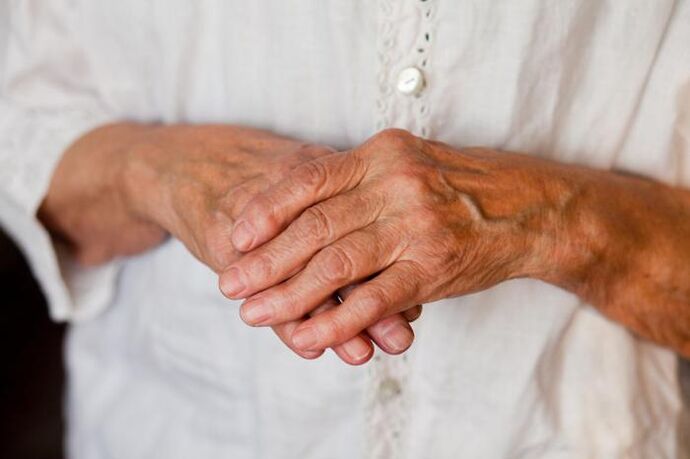 Sakit pada sendi tangan sering mengganggu orang yang lebih tua