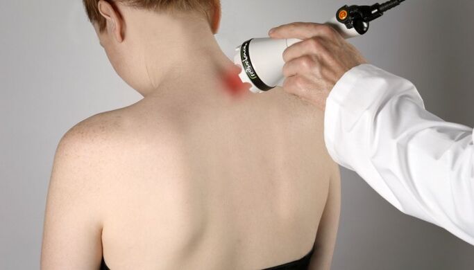 Terapi laser untuk osteochondrosis serviks